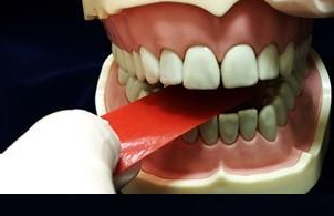 檢查咬合關係並調合