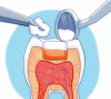 深圳牙醫建议，牙本質敏感的患者要及時到深圳專業牙科診治！