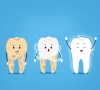 如果牙套掉了該怎麼辦？深圳牙套多少錢？