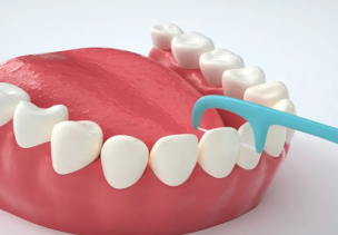深圳杜牙根最新收費？牙痛導致牙神經壞死應該怎麼辦？