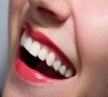 牙齒美白方法有哪些？深圳牙齒美白收費價目表？