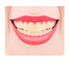 深圳看牙|着色牙是什麽原因引起的？有治療的方法嗎？