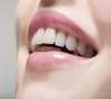牙齒美白效果可以用幾耐？深圳牙齒美白幾錢？