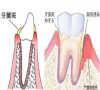 在深圳牙齒患有牙菌斑的怎麼辦？形成的原因是怎麼？