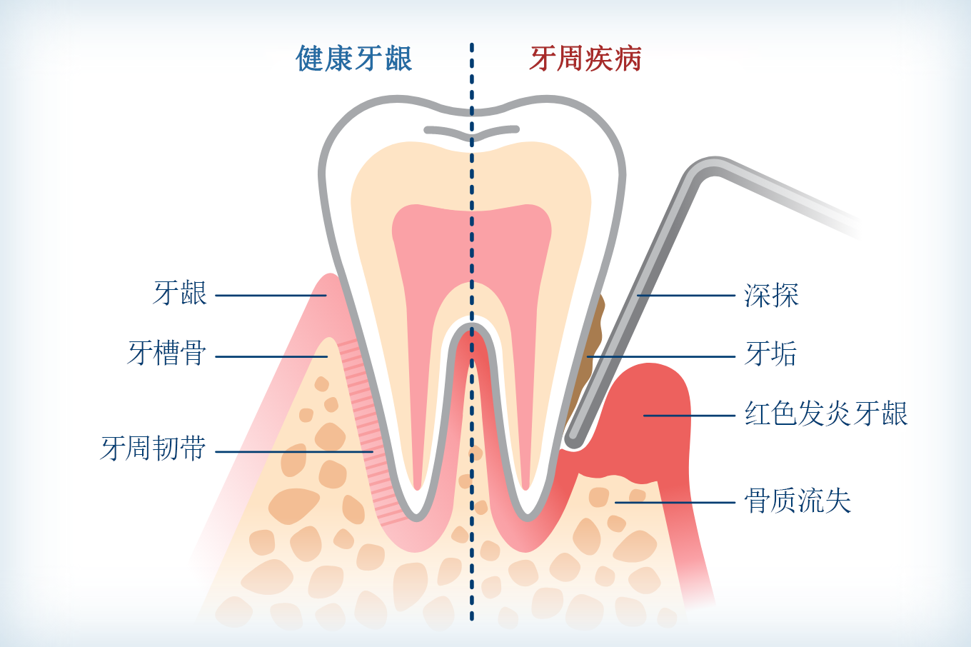 深圳牙周病