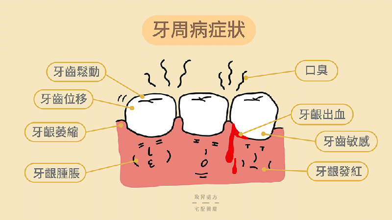 深圳牙周病治療