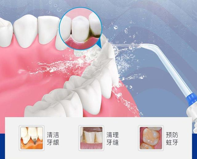 深圳三康口腔洗牙