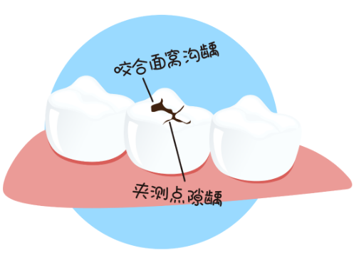 深圳三康口腔補牙