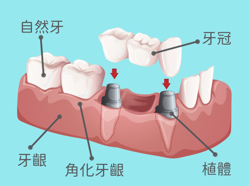 深圳維港口腔連鎖