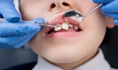 爸媽牙齒不齊會遺傳給自己的小孩嗎？